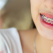Aparatul dentar și igiena orală: Sfaturi și recomandări